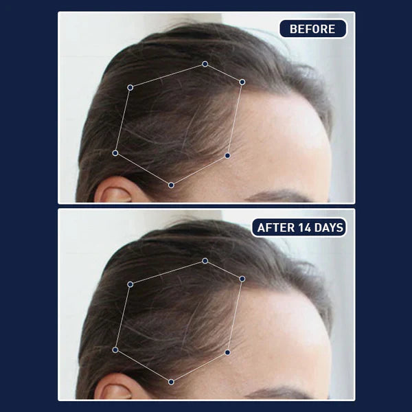 FEG Hair Growth Serum – German Technology for Faster Hair Growth سيروم FEG لتسريع نمو الشعر بتقنية ألمانية متطورة