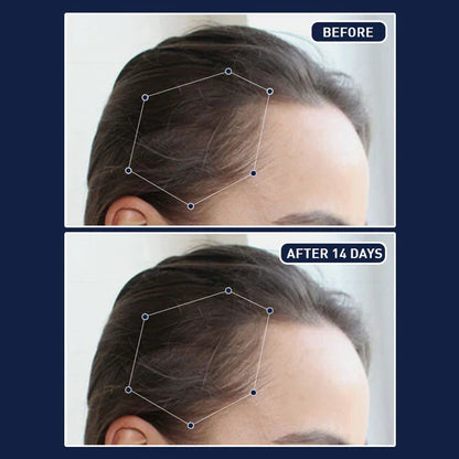 FEG Hair Growth Serum – German Technology for Faster Hair Growth سيروم FEG لتسريع نمو الشعر بتقنية ألمانية متطورة