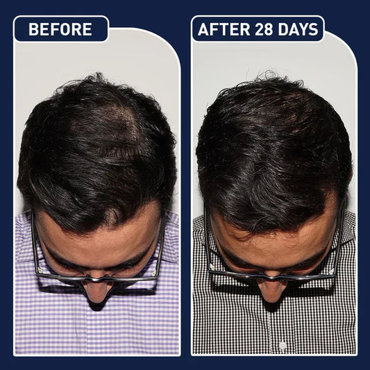 FEG Hair Growth Serum – German Technology for Faster Hair Growth سيروم FEG لتسريع نمو الشعر بتقنية ألمانية متطورة